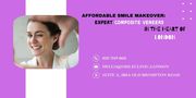 Affordable Smile Makeover: Expert Composite Veneers in London